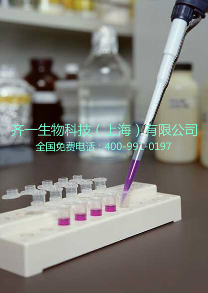 肌酸檢測(cè)試劑盒